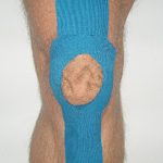 Kinesiotape - Ich kleb´ dir eine! Meditaping für Anfänger