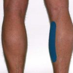 Kinesiotape - Ich kleb´ dir eine! Meditaping für Anfänger